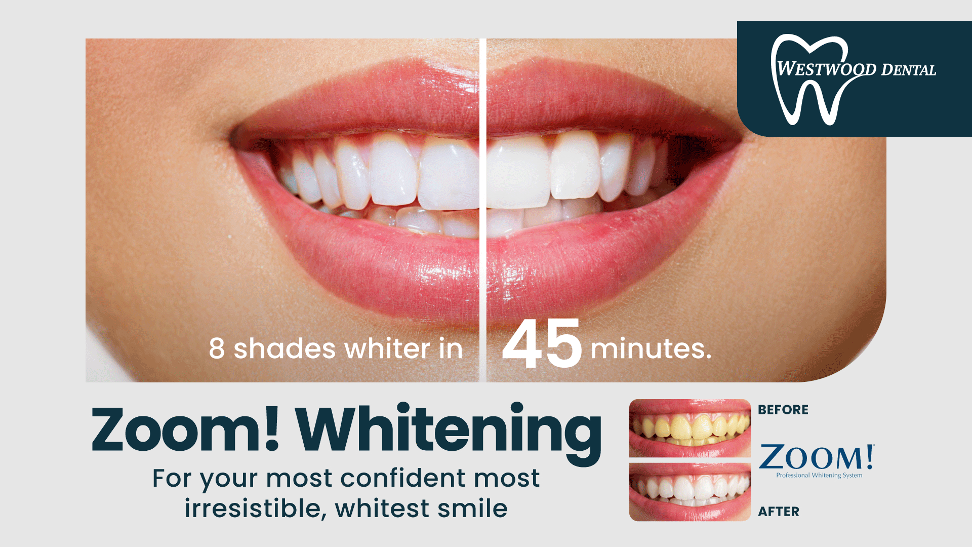 8 shades whiter in 45 minutes. 'Zoom!' Whitening. For your most confident most irresistible, whitest smile.