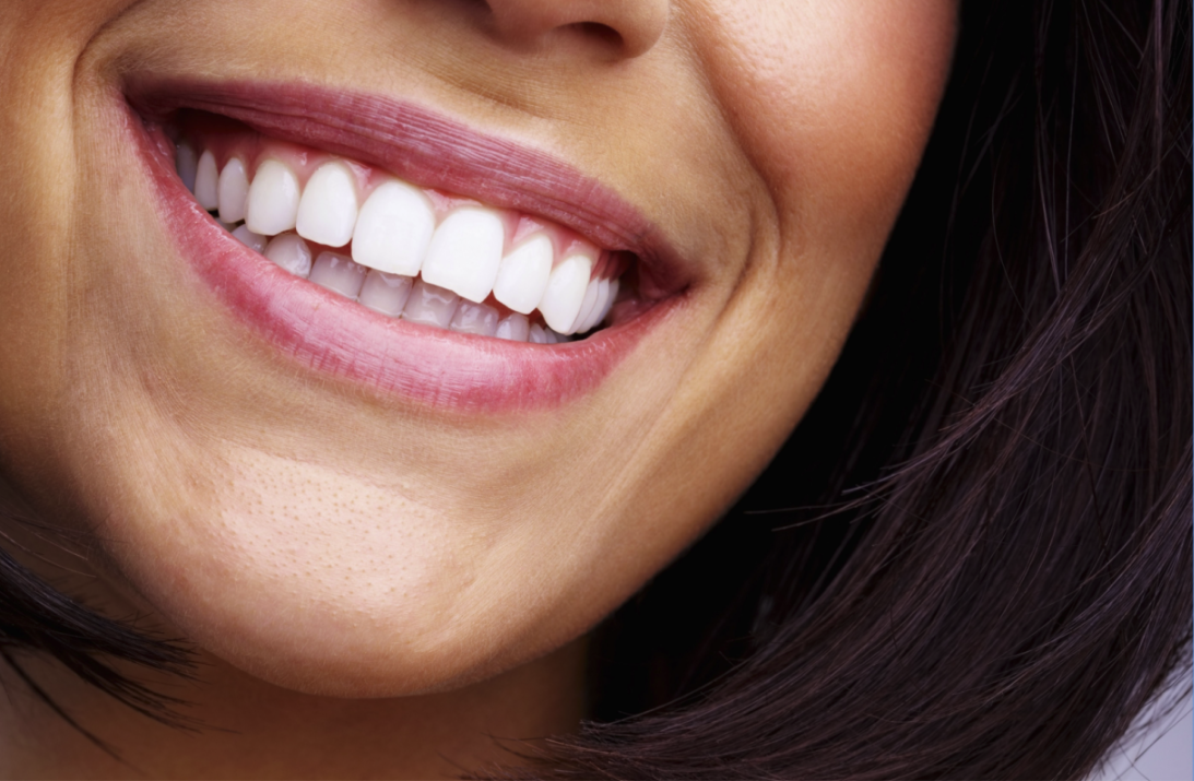 Close-up of a woman’s smile showing bright white teeth and healthy pink lips.